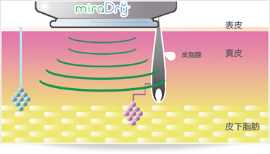 マイクロ波照射イメージ