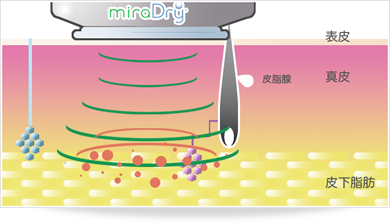 マイクロ波照射イメージ