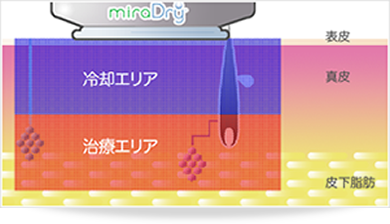 マイクロ波照射イメージ