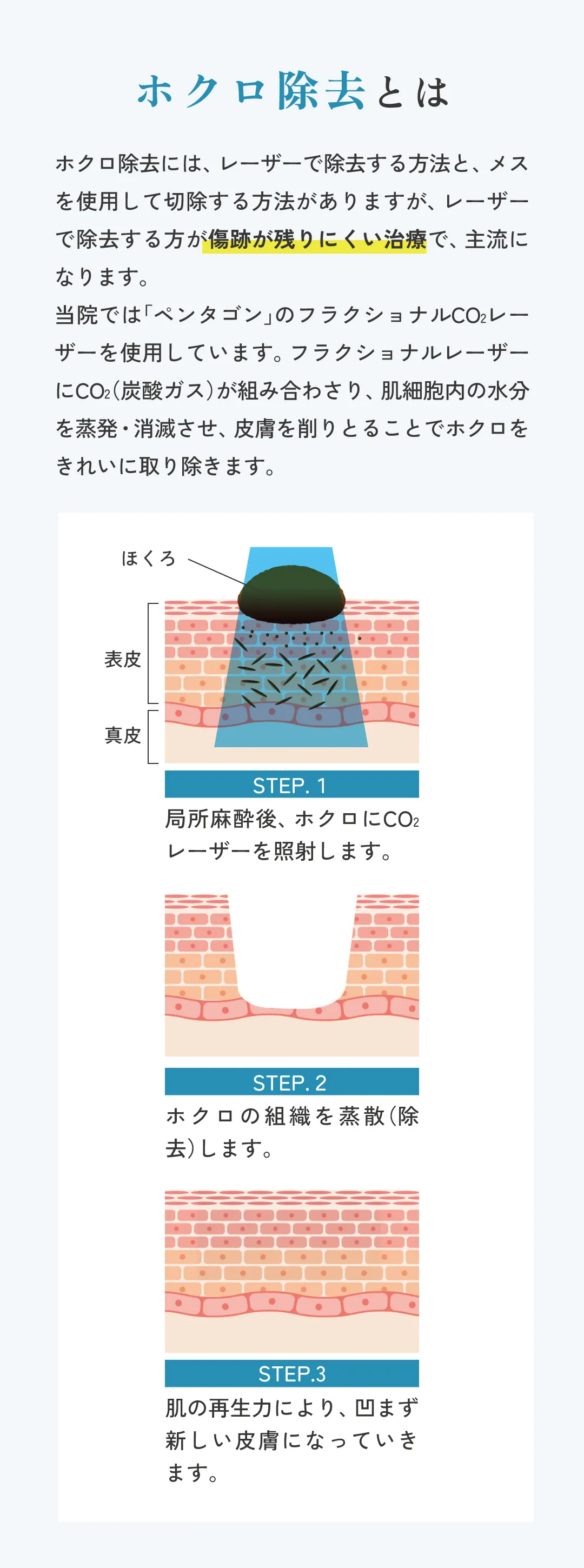 ホクロ除去とは